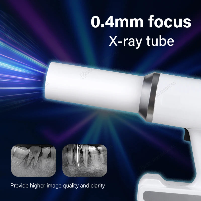 Handheld Dental X-Ray Machine - High Frequency & Low Radiation